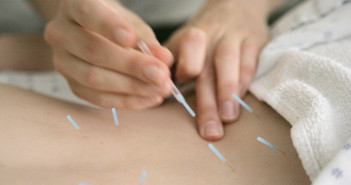 AP ACUPUNCTURE PAIN RELIEF A USA IL