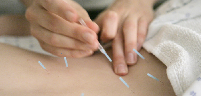 AP ACUPUNCTURE PAIN RELIEF A USA IL