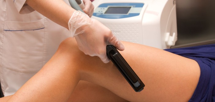 Varicose Veins: How They Change Your Daily Life Veins