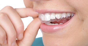 Invisalign: Does it Hurt Like Regular Braces? Braces Invis