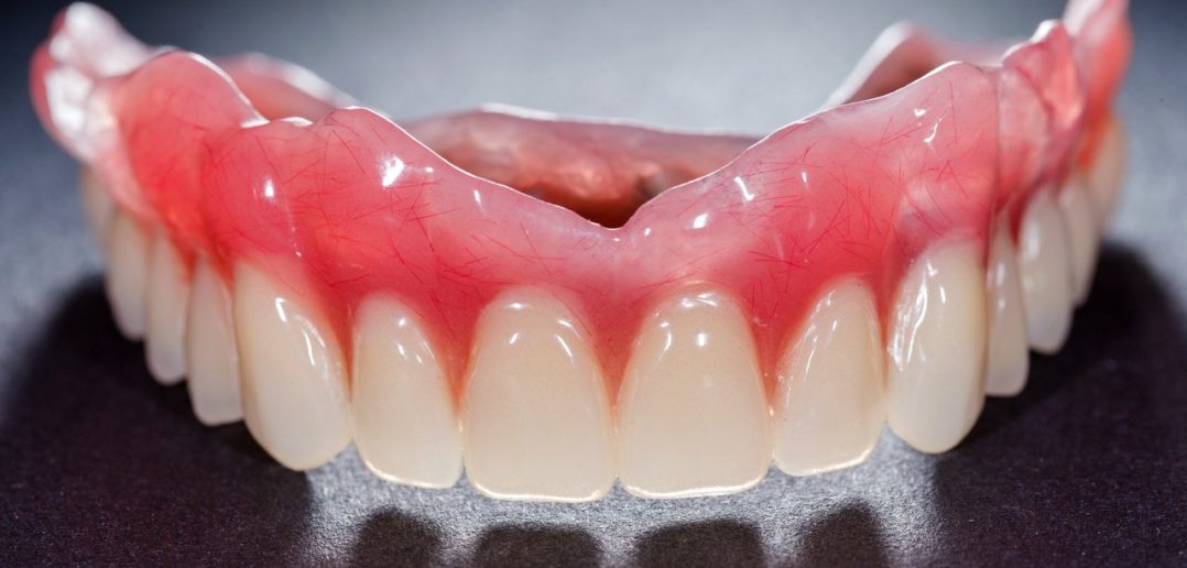3 Things You Must Do to Keep Your Dentures Clean