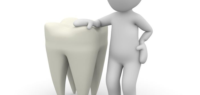 5 Facts to Know About Having Porcelain Veneers Veneer